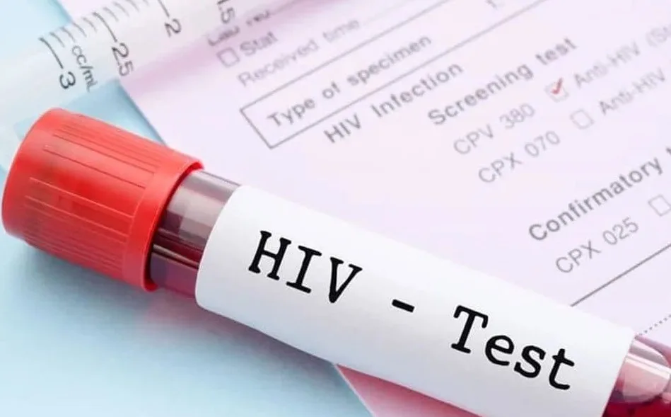 (VIDEO) U Crnoj Gori sa HIV-om živi više od 500 osoba, u ovoj godini registrovan 41 slučaj 1 (VIDEO) U Crnoj Gori sa HIV-om živi više od 500 osoba, u ovoj godini registrovan 41 slučaj