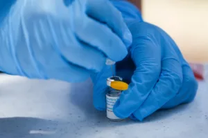 Šef SZO na istoku Konga – središtu epidemije ebole
